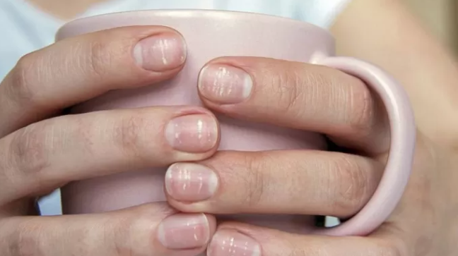 uñas